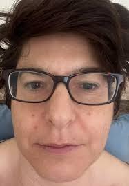 Remove brace from knee picture