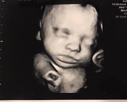 Aalborg Scanningsklinik