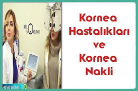 Kornea Hastaliklari Ve Kornea Nakli Resources Website Topics