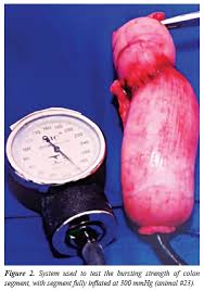 Colonic resection with primary anastomosis and defunctioning ileostomy. Role Of Bowel Preparation On Colocolonic Anastomosis Experimental Study In Dogs