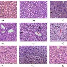 Maybe you would like to learn more about one of these? Liver Sections Viewed Under Light Microscope With 400x Magnification Download Scientific Diagram