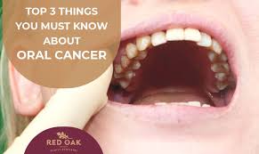 Image result for dental cancer