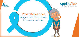 Most prostate cancers are found early, through screening. Prostate Cancer Stages And Other Ways To Assess The Risk Apollo Clinic Blog