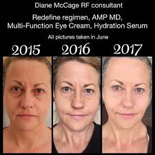 Aging backwards?! #RedefineAging #RealResults