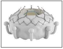 Transcatheter Solutions For The Tricuspid Valve Cardiac Interventions Today