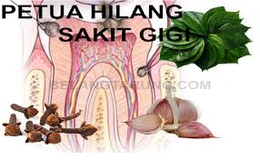 Cara mengobati gusi bengkak secara alami dengan lemon: 7 Petua Mudah Hilangkan Sakit Gigi Tanpa Ubat My Info Maya