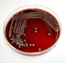 Image result for yersinia fotos