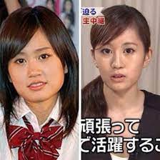 芸能人の顔整形ビフォーアフター もう誰だかわからんｗ kwskライフ plastic surgery celebs entertaining