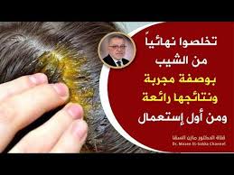 أفضل طرق التخلص من الشيب وازالة الشيب من الشعر نهائيا حتى لوكان الشعر يغزوه الشعر الأبيض نتائج مبهرة Youtube Beauty Care Beauty Makeup Youtube