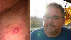 Paradise Hotel, Kjendis