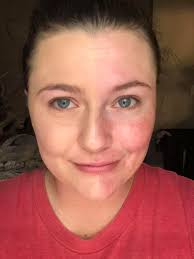 Foundation options for different skin needs