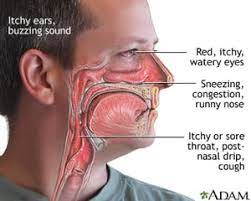 Whether you have hearing loss, recurrent sinus infections or a neck mass, a specialist in the sutter health network may be able to help. Ear Nose And Throat Allergies Jeffrey E Goldberg Md
