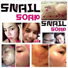 Tofu Soap Vs Snail Soap Review Which Is Better Cream Review Blog Skin Firming Simple Skincare Skin Care Techniques