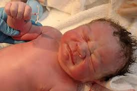 Ich ziehe mit einer speziellen fasszange den faden der einige millimeter in den muttermund hineinragt. Unglaublich Dieses Bild Eines Babys Mit Spirale In Der Hand Geht Um Die Welt Gala De