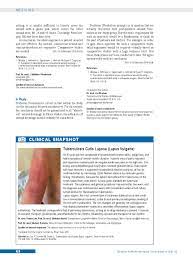 Tuberculosis cutis orificialis is a rare form of tuberculosis more often secondary to pulmonary orifical tb infection develops due to autoinoculation of bacilli from primary active tuberculous source. Tuberculosis Cutis Luposa Lupus Vulgaris 22 06 2018