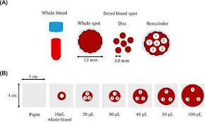 Image result for Newborn Screen