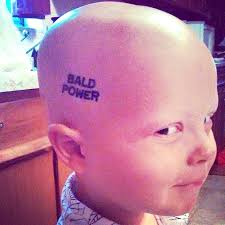 Marvelous Mondobaldo Peeps Today We Turn Our Spotlight On Mr Cale Schremp And By The Look In His Bald Powered Eyes We Hair Loss Hair Loss Alopecia Alopecia