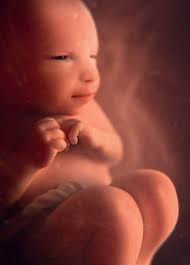 Legaten & Giften in Praktijk: Legs & Dons en Pratique: