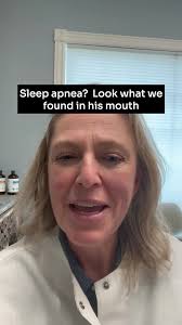 Discovering the Hidden Cause of Sleep Apnea at Age 16