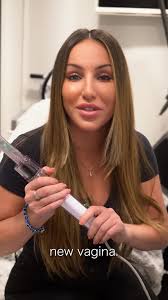 Morpheus 8 Results After 3 Treatments