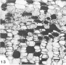 Image result for Allocassine laurifolia