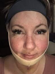 Forrest S. Roth, MD, FACS, Board Certified Plastic Surgeon