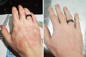 I Tried An Armpit Detox And Wow My Armpits Look Incredible Now Skin Care Wrinkles Skin Moisturizer Dry Skin