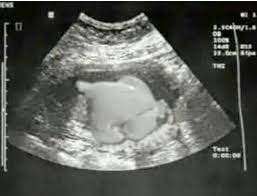 Funny Preg Pic Turkey Ultrasound Thanksgiving Preg Humor Ultrasound Getting Pregnant Fake Ultrasound