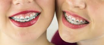 Learning how to whiten teeth with braces can be tricky, and you must be very cautious. Can I Bleach My Teeth With Braces On Dougherty Orthodontics