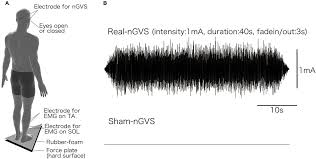 Footcenter est un magasin en ligne consacré à la vente de produits de football qui couvre plus de 60. Frontiers The Effects Of Stochastic Galvanic Vestibular Stimulation On Body Sway And Muscle Activity Human Neuroscience