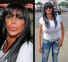 Youn, priscilla presley revealed that she . 21 Celebrity Plastic Surgery Nightmares Before After Celebrities Nigeria