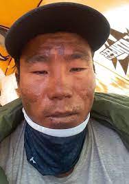 Dr chin's wife, thanaporn lorchirachoonkul, declined to speak and requested privacy. Did Red Tape Fatally Delay The Rescue On Annapurna Explorersweb