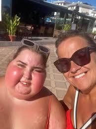 Well we all had a fantastic time away in Turkey, I am so pleased we didn't  listen to Ella's oncologist and not go. The warm weather did Ella the world  of good