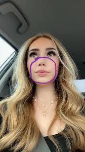 Experiencing facial numbness during treatment?