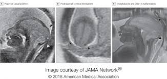 Our customized solutions in medical imaging technology extend across all. Sequential Imaging Of Zika Exposed Fetuses Reveals Most Have Normal Brain Development Eurekalert Science News