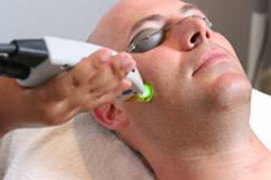 Thrive skin + wellness specializes in cosmetic treatments like laser hair removal & skin resurfacing in raleigh, nc. Cary Laser Hair Removal Treatments For Men Raleigh Cosmetic Surgeon