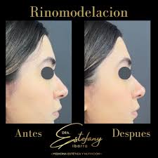 Dra. Estefany Ibarra