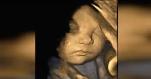 doktorlar anne adayina ultrasonda siradisi bir sey gorduklerini soylediler annenin cevabi ise inanilmaz oldu