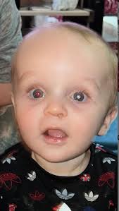 I'm reaching out today with a heavy heart. We are facing an incredibly  difficult time, and your support can make a world of difference for Gemma  and her family. Please consider donating