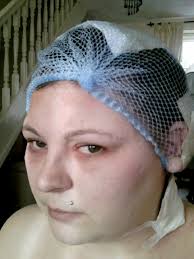 GALERIE: Oběť kosmetiky! Dívka (25) oslepla poté, co si nabarvila vlasy