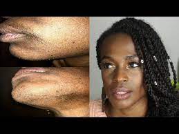 Facial hair removal has been part of my beauty routine since i was a teen. Finishing Touch Flawless Hair Remover 1 Month Update This Product Is Thrasshhh Youtube