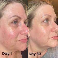 ano po yung maganda na korean brand for skincare yung anua or skin 1004?