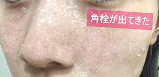 pluest プルエスト 2021 スキンケア用品 毛穴 スキンケア