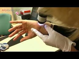 Elle (chercher) la cassrrole bleue danse le beffet. Diagnostiquer La Gale Allo Docteurs Youtube