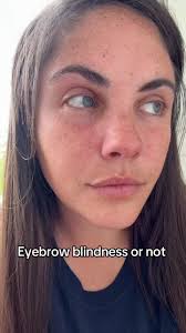 Emma Iverson Eyebrow Blindness
