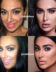 Check spelling or type a new query. What Do Ig Accounts Like Celebface Get Out Of Exposing Celebrity Surgery Dazed Beauty