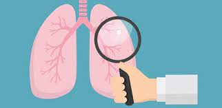 According to the mayo clinic, lung cancer is the leading cause of cancer death in the united states. What S New Archives Wake Radiology