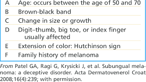 Looking for the definition of abcdef? Abcdef Guideline For Assessing Subungual Melanomas Download Table