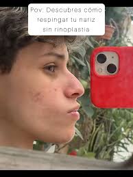 How to Get a Thinner Nose