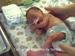 Resultado de imagem para dIA DA CRIANÇA pRAMATURA rj